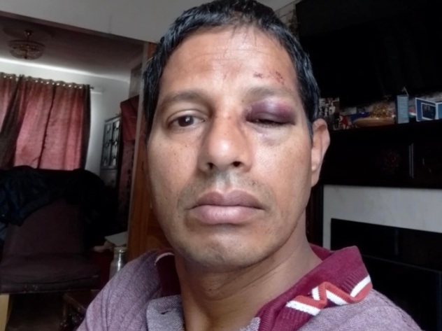 laxman-das-injured.jpg